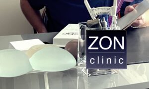 Implanty anatomiczne czy okrągłe – porównanie efektów powiększania piersi w ZON CLINIC dr Bartłomiej Zoń