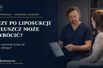 Czy po liposukcji tłuszcz może wrócić – dr Bartłomiej Zoń podczas konsultacji w ZON CLINIC