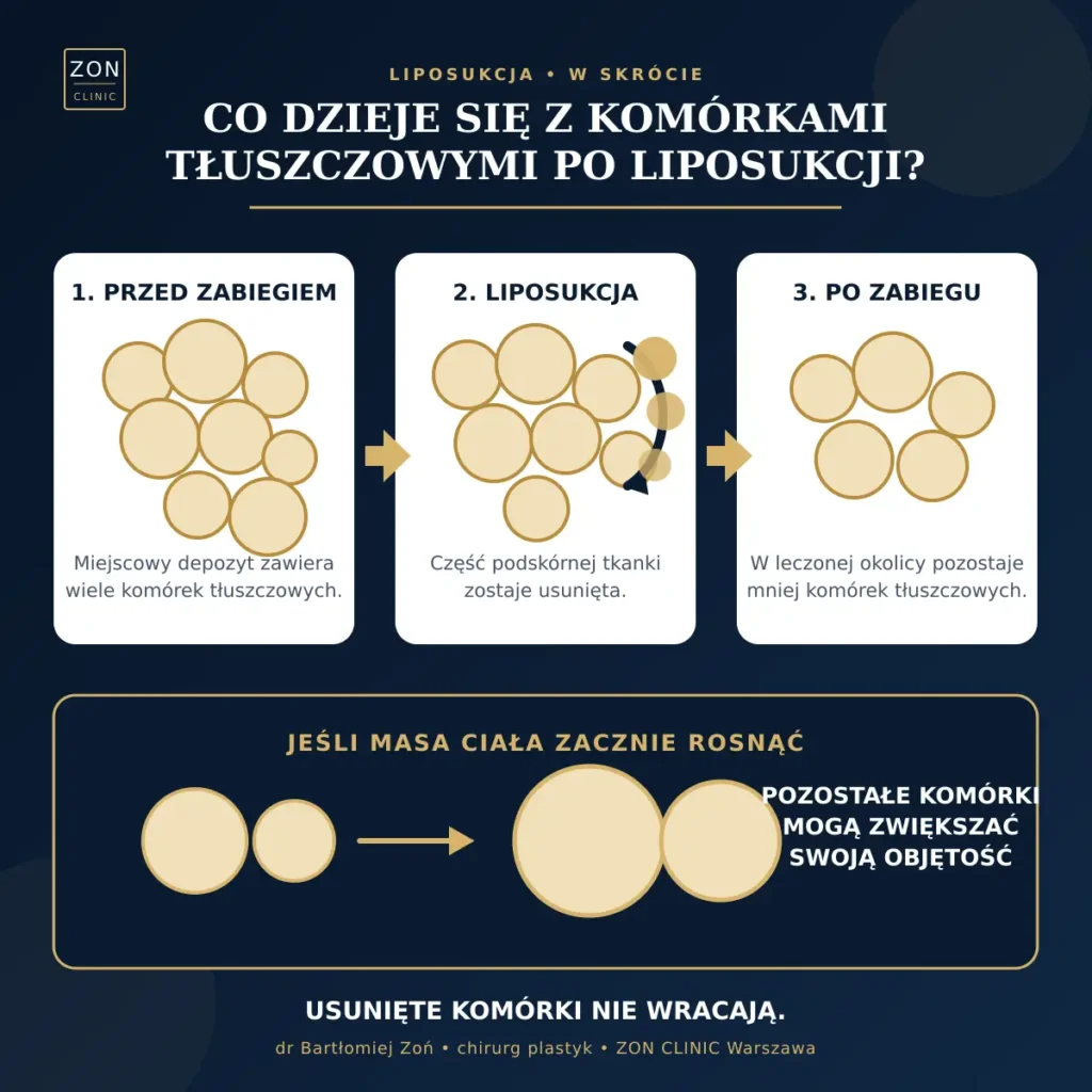 Komórki tłuszczowe po liposukcji – usunięte komórki nie wracają, a pozostałe mogą zwiększać objętość.